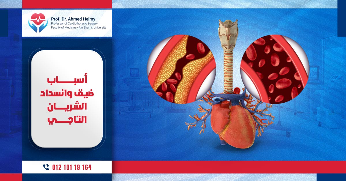 ضيق وانسداد الشريان التاجي واسبابه