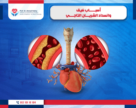 ضيق وانسداد الشريان التاجي