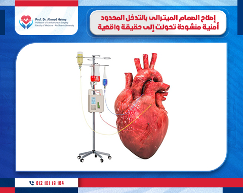 اصلاح الصمام الميترالي بالتدخل المحدود أمنية منشودة تحولت إلى حقيقة واقعية