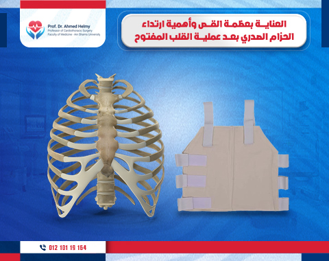 العناية بعظمة القص وأهمية ارتداء الحزام الصدري بعد عملية القلب المفتوح 1