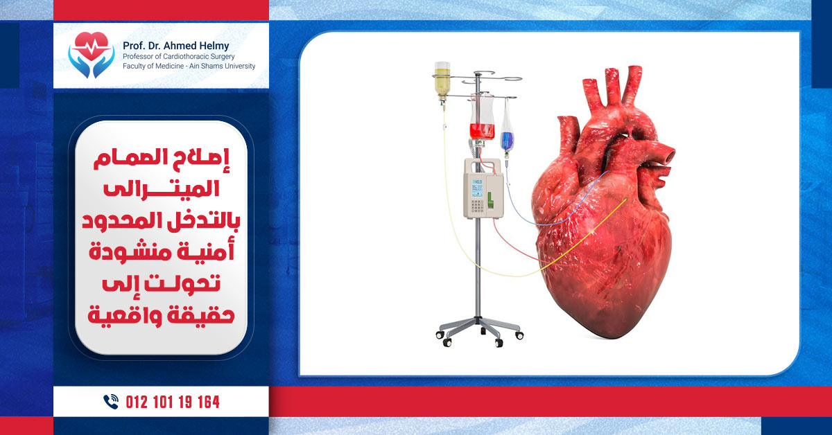 عمليات التدخل المحدود لاصلاح الصمام الميترالي بأمنية منشودة تحولت إلى حقيقة واقعية